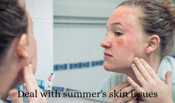 Deal With Summer Skin Problems