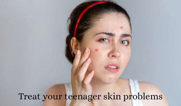 How to treat skin problems as a teenager